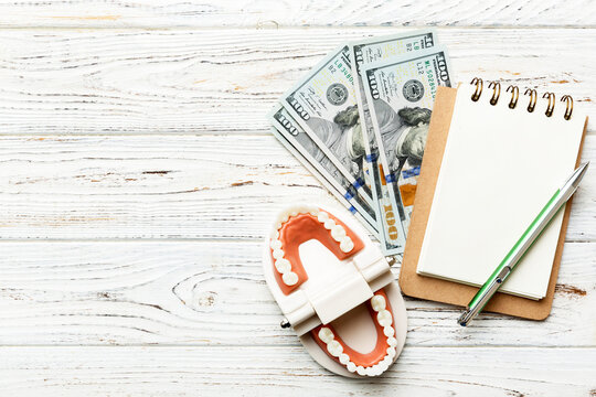 Flat lay composition with educational dental typodont model and money with notebook on colored table, top view. Expensive treatment