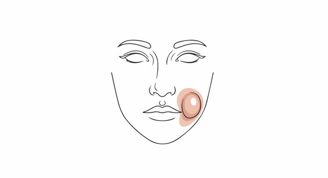 Minimalist line art of a face with a red, inflamed bump on the cheek