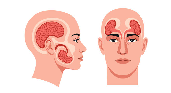 Front and side views of a human head with highlighted sinus cavities to illustrate sinusitis or respiratory health.