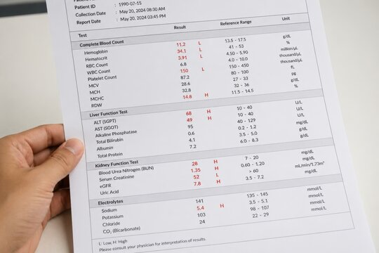 Asian person reviewing detailed medical report with blood count, liver function, and kidney data. concept of health analysis, medical documentation, personal healthcare.