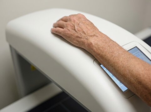 Senior person undergoing a bone density scan of the hand