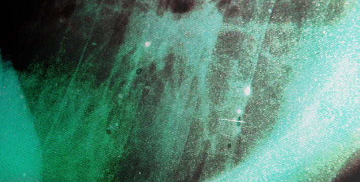 Abstract blue grunge texture with xray anatomy elements and distressed overlay. Medical background with film scratches, dust and vintage noise effect.