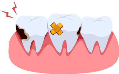 Obraz premium Human tooth decay with cavity and dental caries illustration