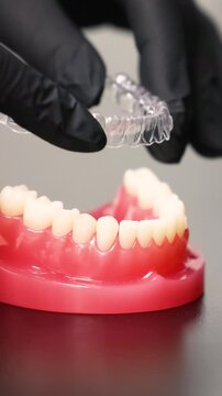 Clear dental aligners placement on jaw model training demonstration
