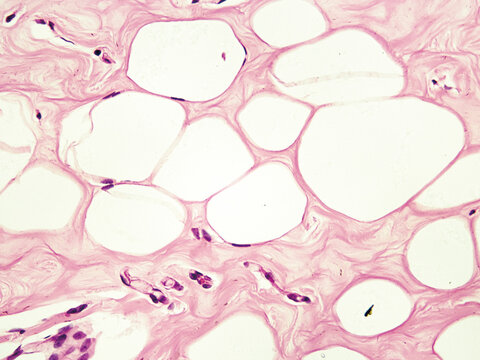 Under an optical microscope, the adipocytes appear as large vacuoles with flattened nuclei located at the cell edge. These are adipocytes from a woman's resting mammary gland. Magnification: 400&times;Print