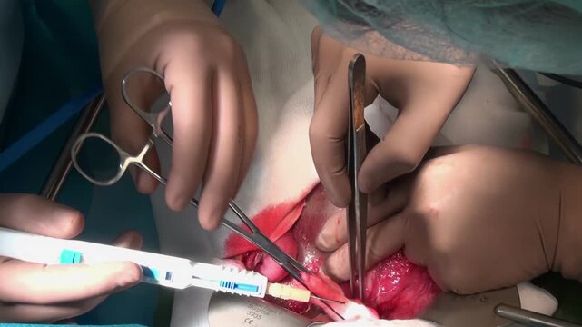 In this intimate presentation, surgeons meticulously perform an operation inside a medical facility. Surgical tools are used with precision in a serious medical procedure.