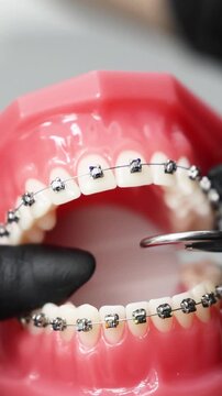 Orthodontist holding jaw model with braces for dental consultation