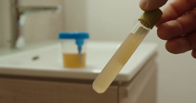 Close-up of a test strip taken from a urine sample in a bathroom, illustrating medical analysis and bacterial testing.