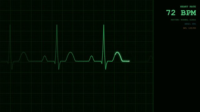 Realistic hospital heart monitor ekg line with bpm display in dark medical setting for healthcare emergencies