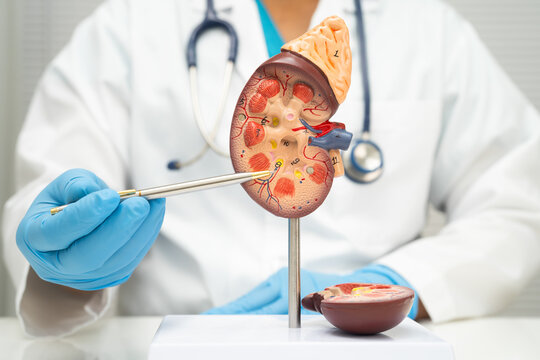 Chronic kidney disease, doctor with model for treatment urinary system, urology, Estimated glomerular filtration rate eGFR.
