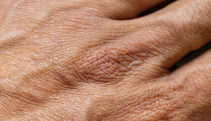 Naklejka premium Extreme Close-up of Human Skin Texture with Fine Lines and Wrinkles,Macro,A detailed macro shot capturing the intricate texture, pores, and natural aging patterns of human skin on the hand.