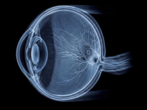 Human Eye.  Artificial Intraocular Lens. Xray Style. Medical Illustration