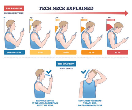 Tech neck explained visual shows head tilt angles raising cervical load while using a smartphone, highlights phone, spine, and posture correction steps. Outline diagram