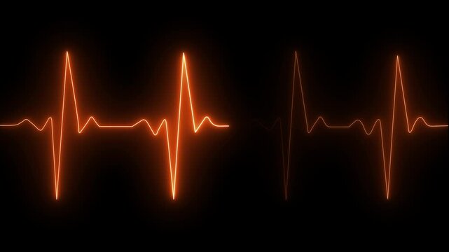 Cardiogram cardiograph oscilloscope screen Green, Ekg Health Shape Medical Backgrounds Loopable. 4k video