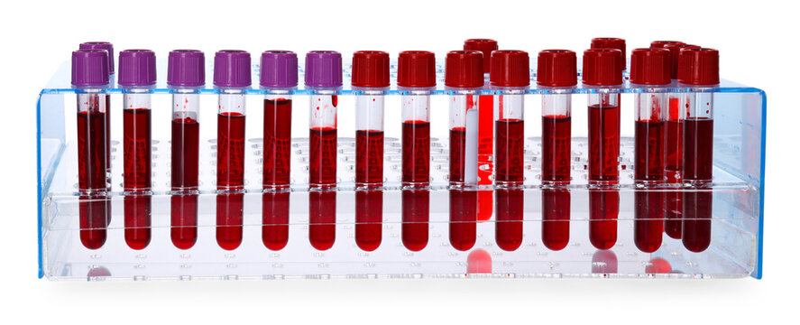 Many test tubes with blood samples in rack isolated on white