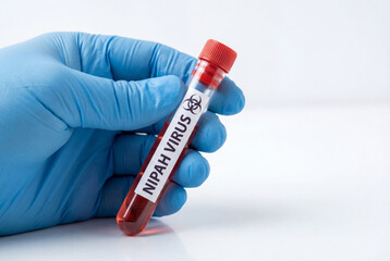 Fototapeta premium Gloved hand holding test tube with blood sample labeled nipah virus