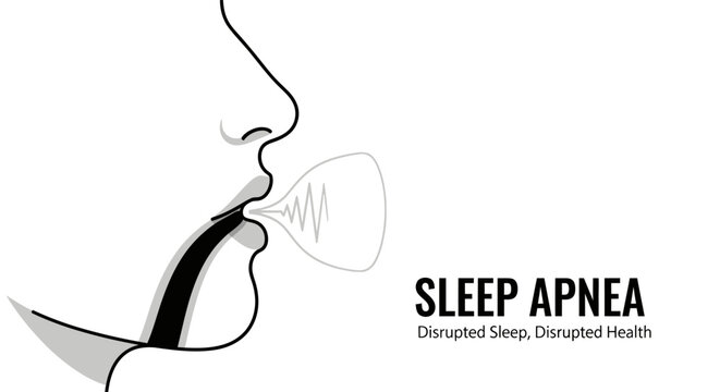 Sleep apnea medical concept illustration, human profile with blocked airway and snoring sound wave.