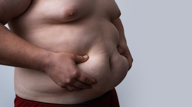 Belly fat shows weight gain. Visible Belly fat increases waistline. Belly fat signals metabolic syndrome. Excess Belly fat shows health condition.