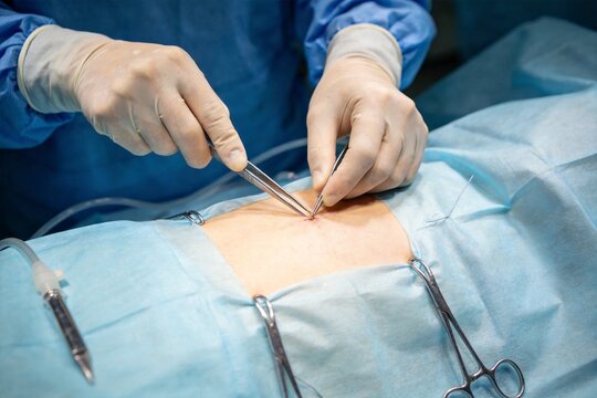 Surgeon performing operation on patient