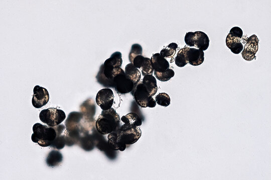 Pollen grains under microscope causing seasonal allergies - optical microscope 200x magnification