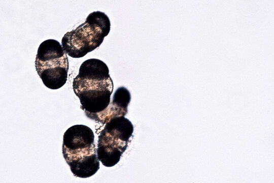 Pollen grains under microscope causing seasonal allergies - optical microscope 400x magnification