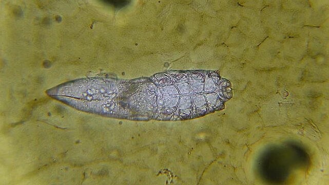 Demodex brevis mite with visible body and chitin structure under 400x magnification brightfield microscopy. 4K scientific microscopy footage.