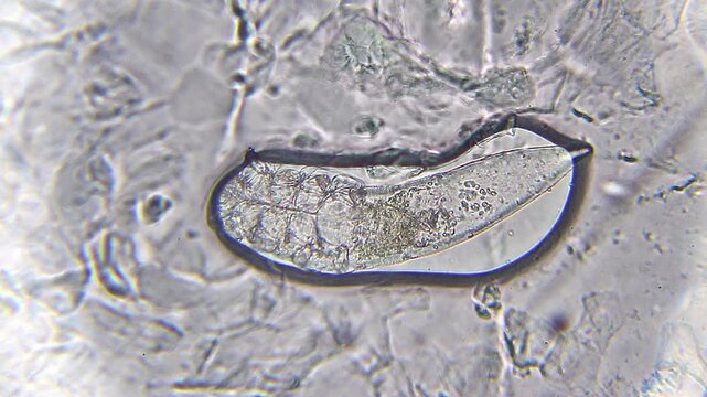 Demodex brevis mite moving appendages with visible body structure under 100x magnification brightfield microscopy. 4K scientific microscopy footage.