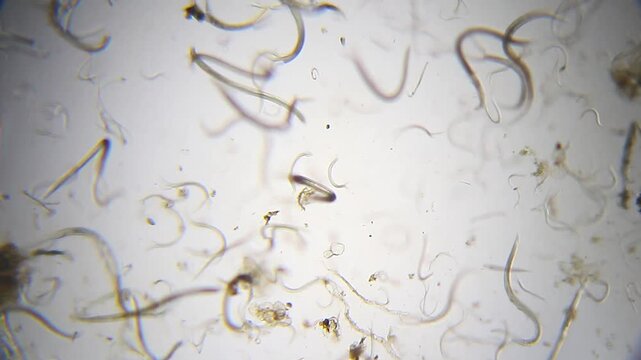 Nematodes aggregation moving rapidly under 40x magnification brightfield microscopy. 4K scientific microscopy footage.
