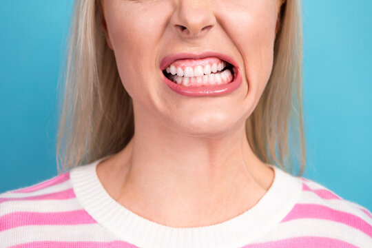 Close-up of woman clenching teeth in tense grimace showing jaw strain and dental expression of stress and frustration