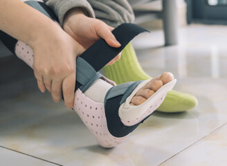 Applying a medical leg splint for injury recovery © Evgenii Bakhchev