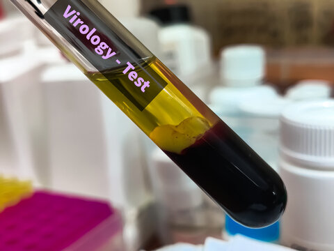 Biological Specimen blood test for detecting IgM and IgG antibodies (ELISA) or molecular PCR tests to detect viral RNA of Orthohantavirus or Hantavirus.