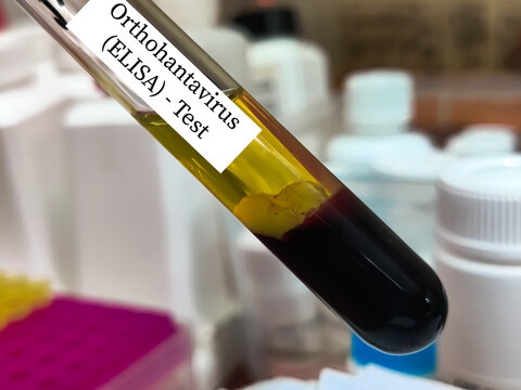 Biological Specimen blood test for detecting IgM and IgG antibodies (ELISA) or molecular PCR tests to detect viral RNA of Orthohantavirus or Hantavirus.