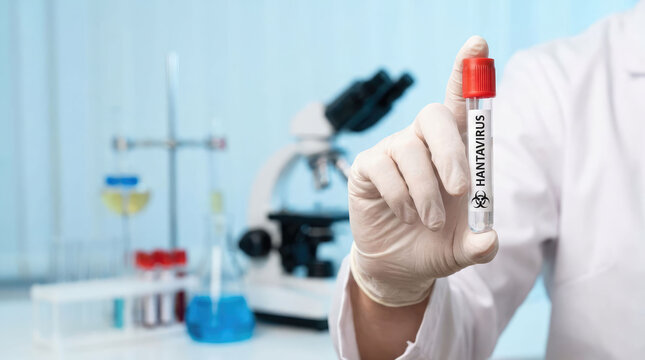 Scientist hand holding Hantavirus test tube in laboratory. Medical research, infectious disease testing, diagnostic safety and lab procedures concept.