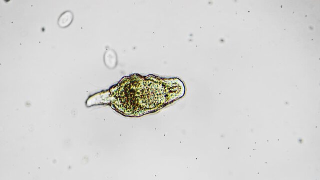 Microscopic pond desmid under microscope green single celled alga with bilateral symmetry, distinct chloroplast lobes, suspended in water with fine algae filaments and microscopic debris brightfield
