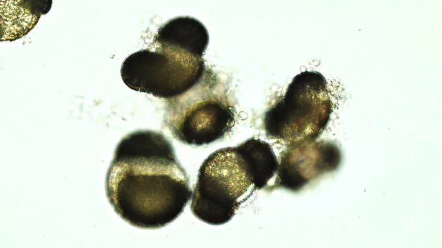 Microscopic pollen grains with focus pull causing seasonal allergies - optical microscope 400x magnification