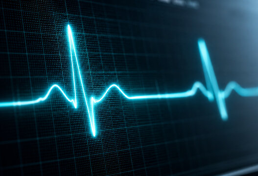 heart beat on monitor