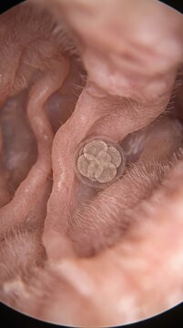 Biological life inception: human embryo, cell division, early growth, uterus development, prenatal stage, future pregnancy, womb anatomy, medical biology.