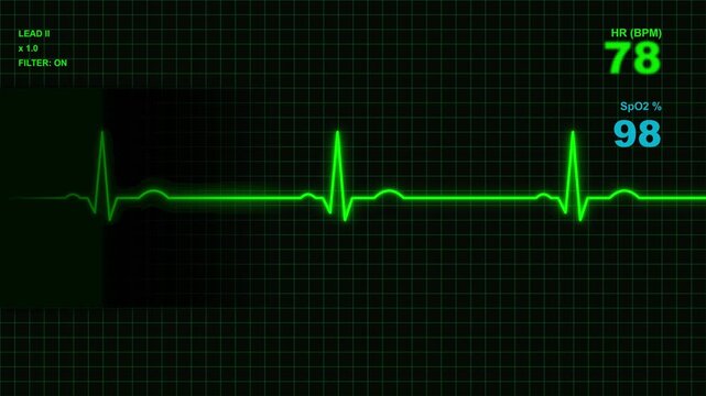 ECG Heart Rate Monitor with SpO2 Reading on Green Grid