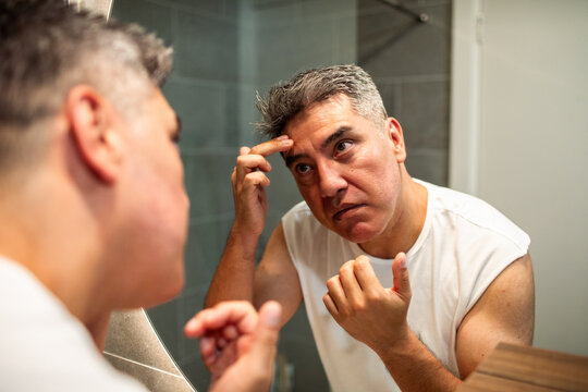 Concerned man examining forehead in bathroom mirror
