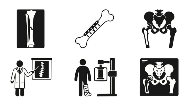 Orthopedic bone fracture and X-ray medical icons set featuring skeleton injury, surgical implants, joint replacement, and doctor diagnostics for trauma clinic healthcare professional visual communicat