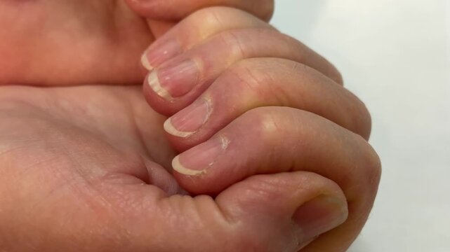 Long unpainted uncut nails of an elderly woman's hands in close-up. Unkempt hands and feet