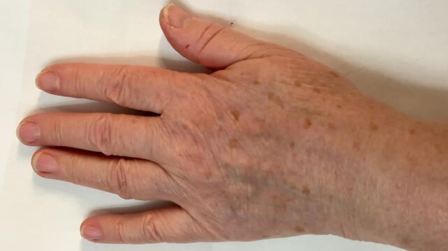 Aged White Woman's Hand Closeup Showing Uncut Nails, Brown Age Spots, Pronounced Wrinkles And Visible Veins, Resting On Neutral Fabric Background Under Soft Natural Light, High Texture Detail