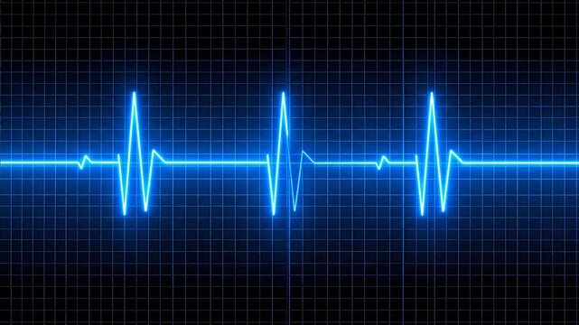 Electrocardiogram heartbeat rhythm on screen.