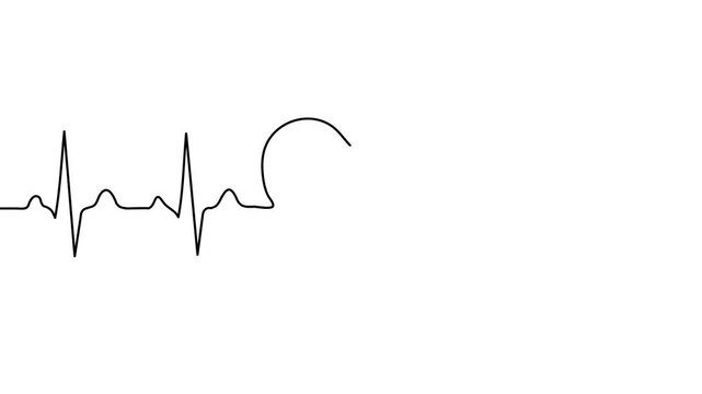 Black electrocardiogram line graph on a white background with transparent background heart rate pulse