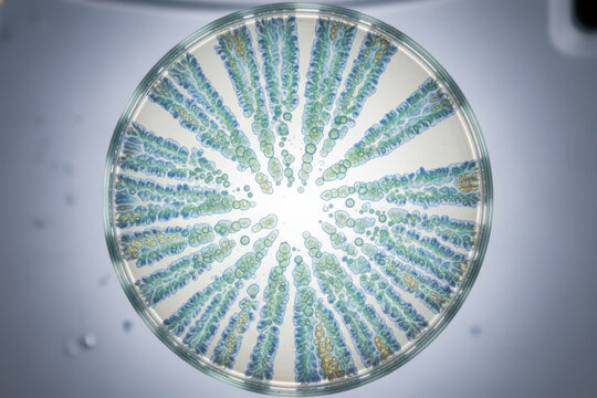 Microscopic view of blue green algae in a radial pattern