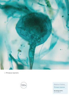 Rhizopus nigricans is a fungus that grows saprophytically on bread, steamed buns, and rice; it is a microorganism frequently utilized in fermentation processes.A sporangium is shown here. Magnify: 400