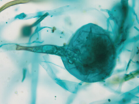 Rhizopus nigricans is a fungus that grows saprophytically on bread, steamed buns, and rice; it is a microorganism frequently utilized in fermentation processes.A sporangium is shown here. Magnify: 400