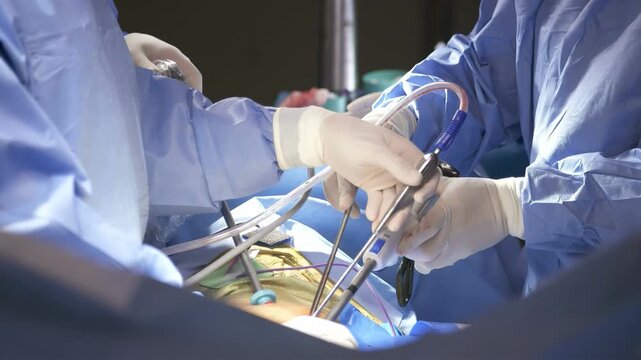Surgeons performing minimally invasive surgery with advanced laparoscopic instruments