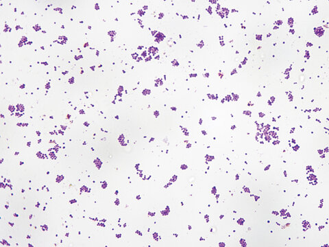 Staphylococcus is a Gram-positive bacterium, spherical in shape, with a diameter of 1 micrometer. Staphylococcus aureus is a pathogenic bacterium. Magnify: 1000&times;.
