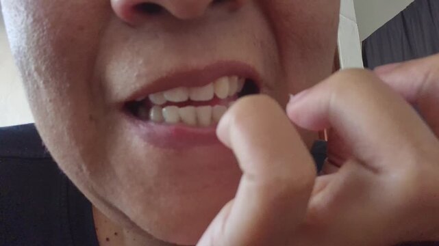 Detail of a person's mouth and hands biting their nails